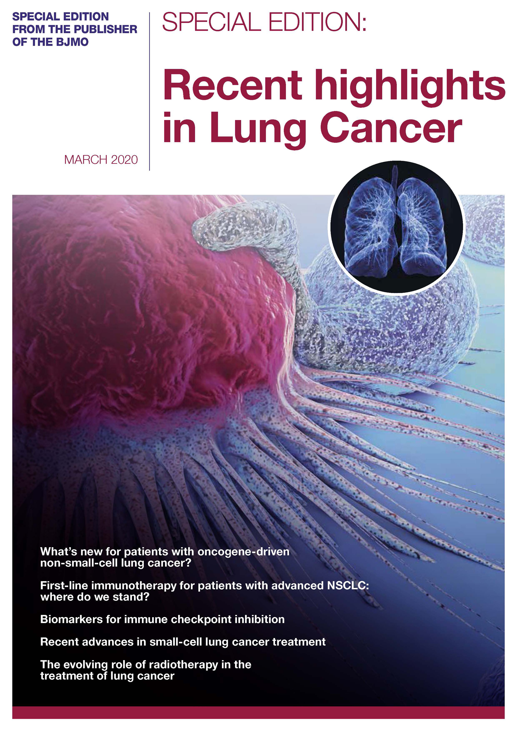 Recent Highlights In Lung Cancer Special, March 2020 - BJMO