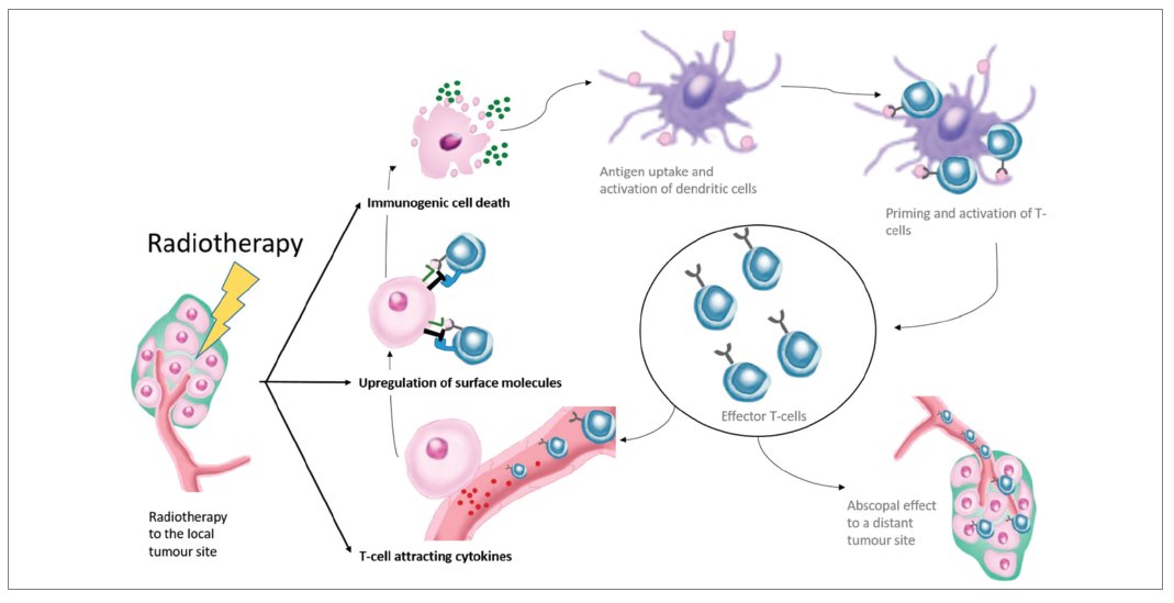 Radiotherapy in the lung cancer immuno-oncology era - BJMO