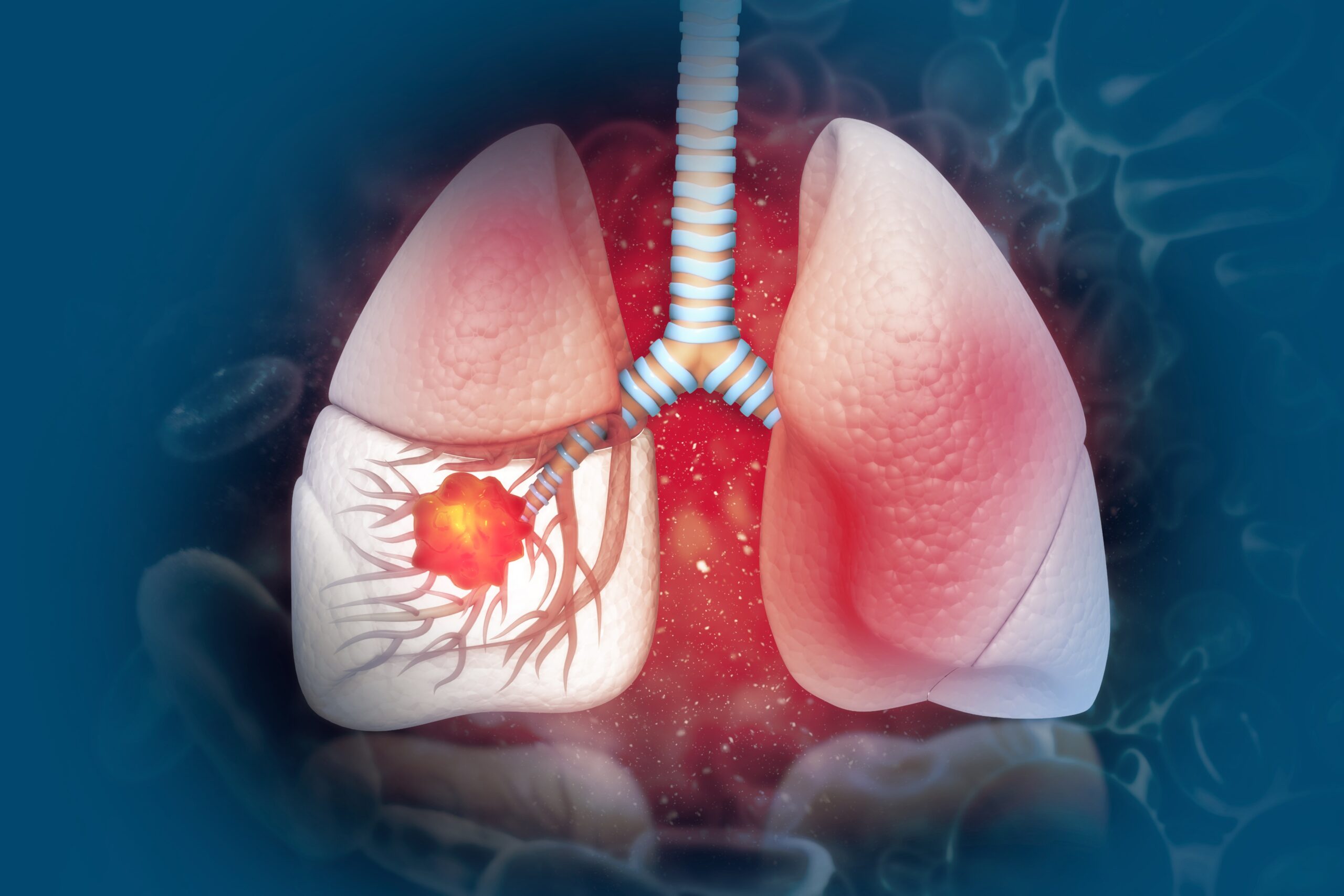 pembrolizumab-keytruda-bjmo